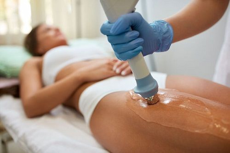 cellulite reduction procedures_6c7b4a7c 5015 440a a8d8 84a2fa1904ba