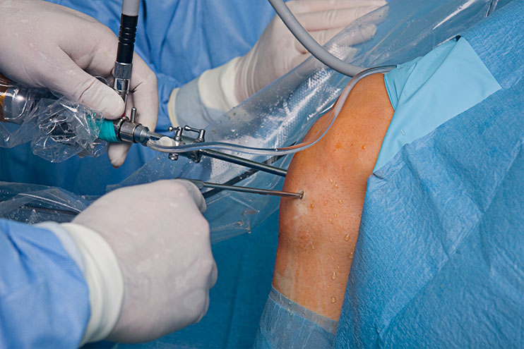 knee replacement surgery what to expect_c805c2fd 48c5 49ec 850c 39b55e9a604d